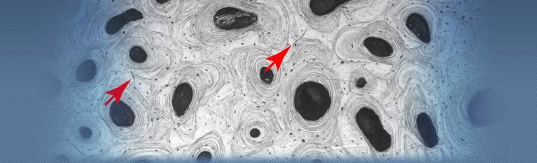 Contrast Agents for Micro-Computed Tomography of Microdamage in Bone