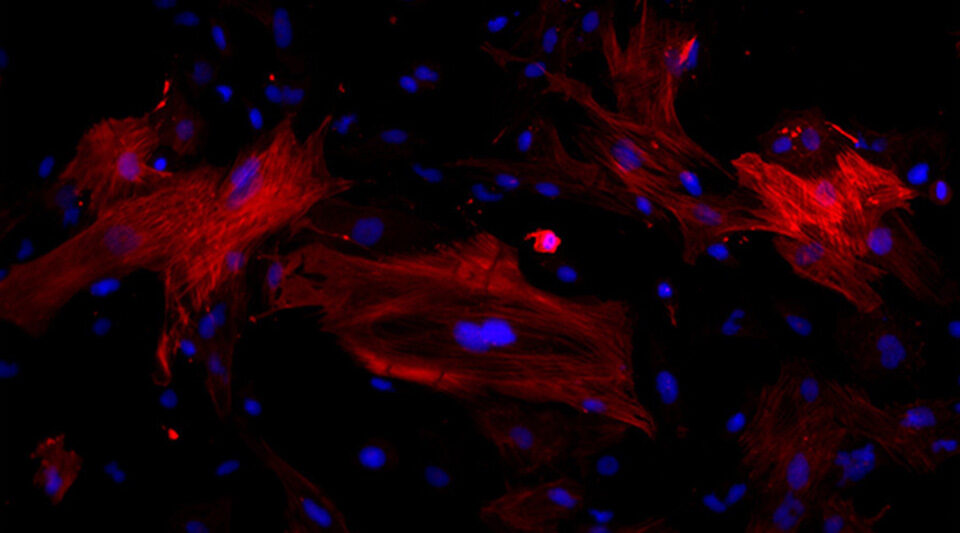 Perivascular fibroblasts observed in the study