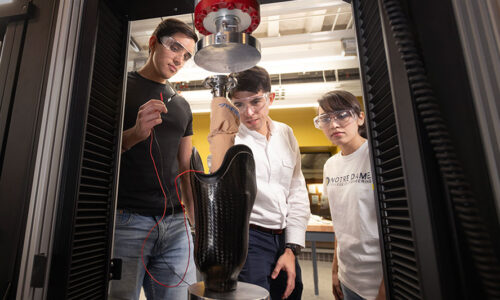 Notre Dame and Purdue engineers use e-textiles and sensor networks to enhance prosthetic fit