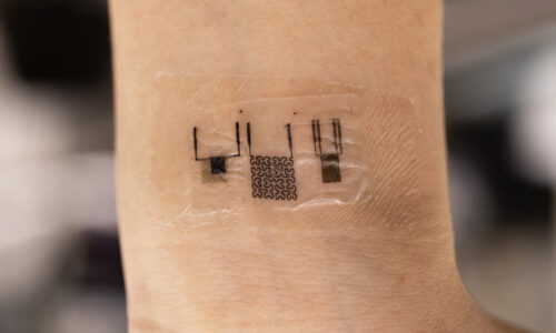 Stretchable bioelectronics promise more accurate health monitoring devices